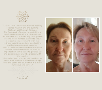 3 PACK of LuminX - Organic Skin Revitalising Elixir 30ml